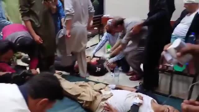 Pakistani forces today killed 12 civilians in different parts of Pakistan Kashmir (Pakistan controlled Kashmir). Civilian unrest gains momentum as Pakistani Rangers & FC use brutal force to fire at the unarmed protestors. Over 150  civilians injured. Latest visuals of a Pakistan controlled Kashmir hospital
